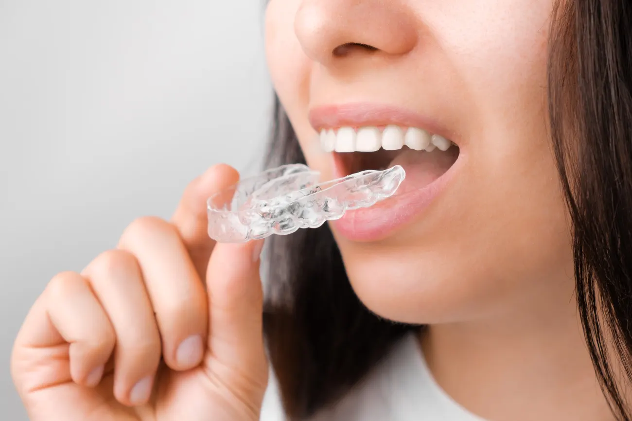 Close up of a young woman adjusting transparent aligners. Taking care of teeth. Orthodontic