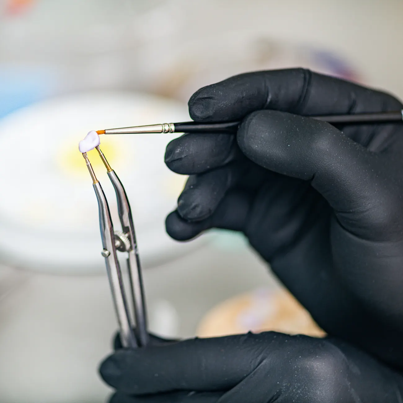 What getting veneers actually involves