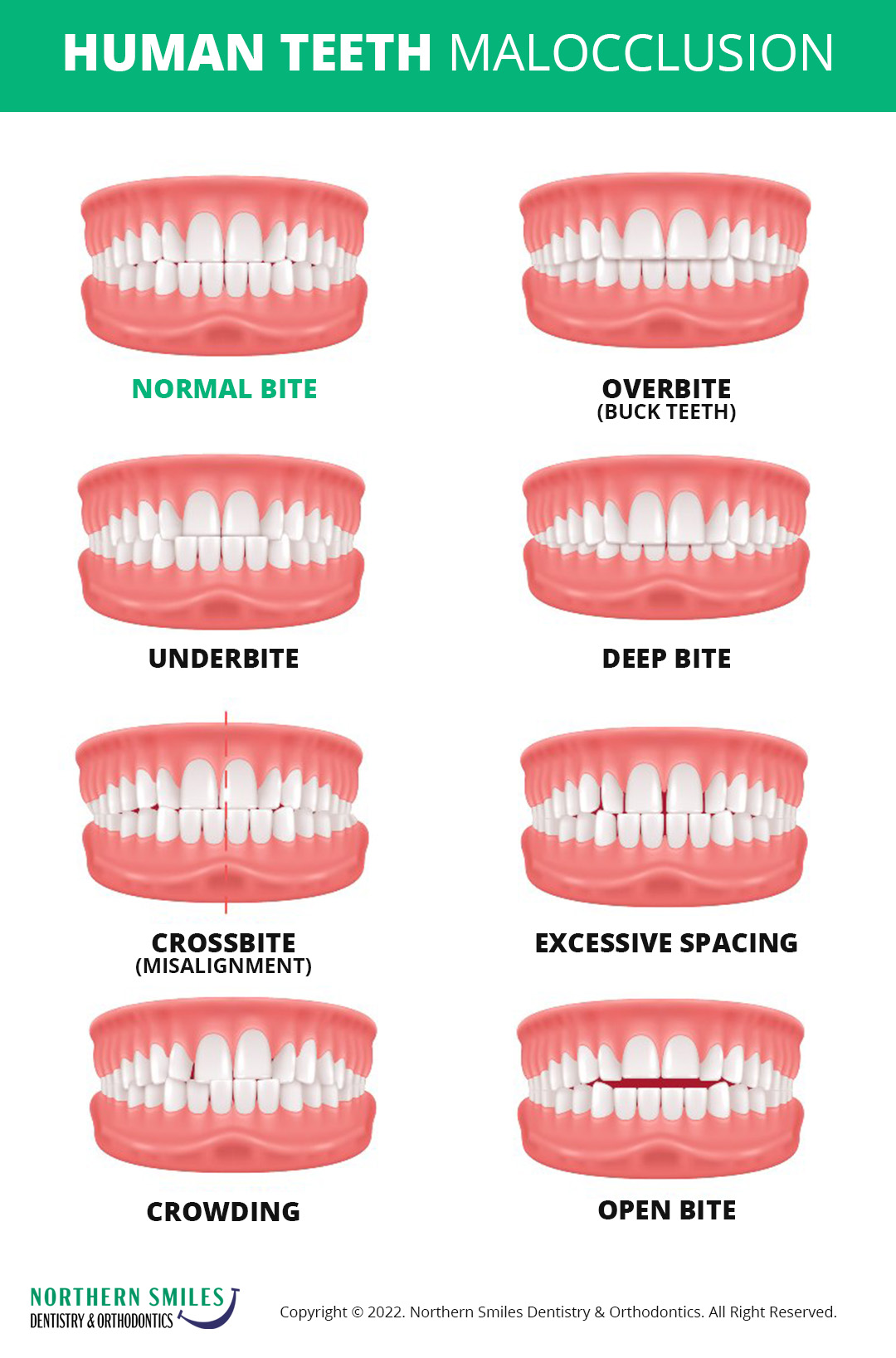 northern smiles malocclusion chart