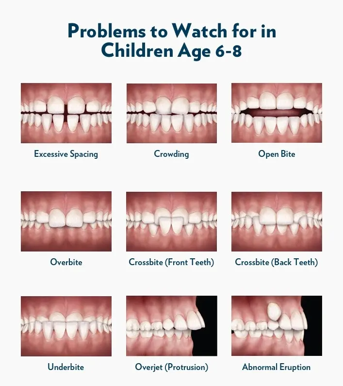 Orthodontic Concerns