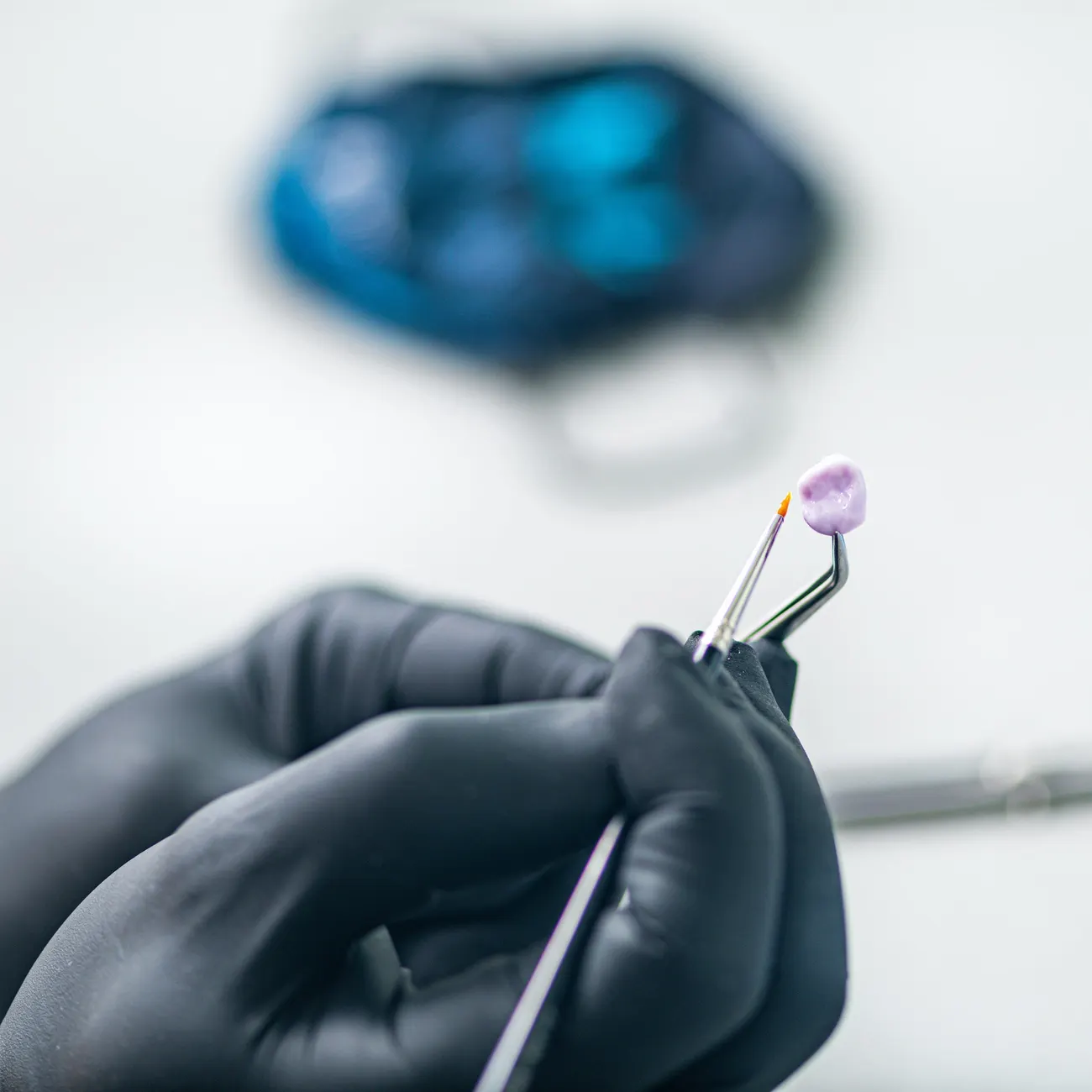 What Are Dental Crowns?
