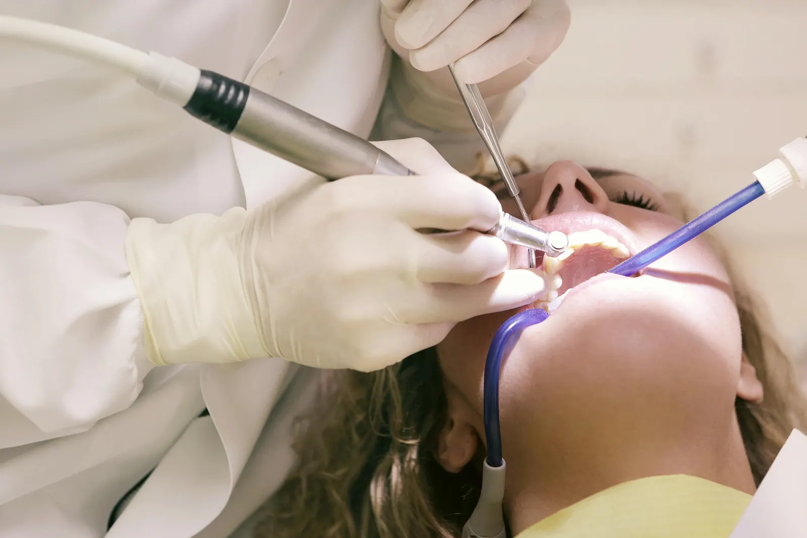 Is dental deep cleaning really necessary?